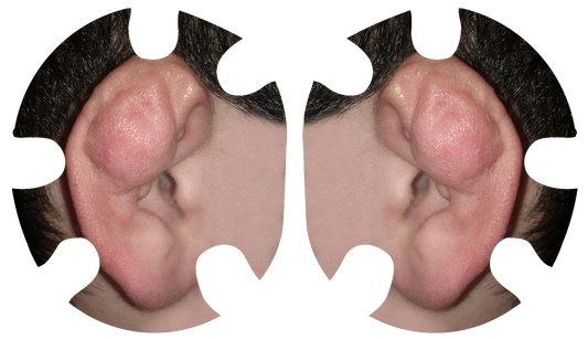 Cauliflower Ear Headgear Decal