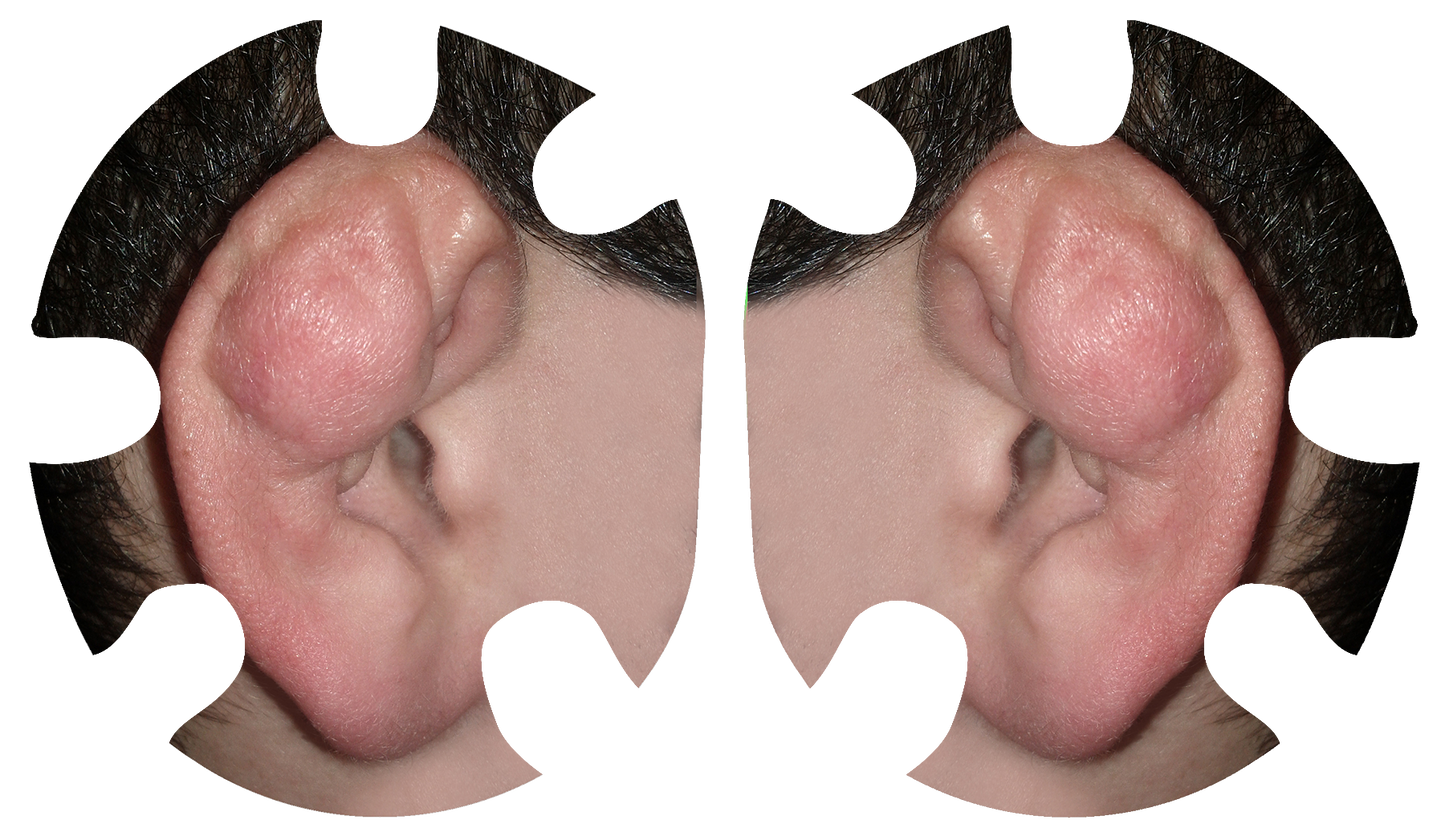 Cauliflower Ear Headgear Decal