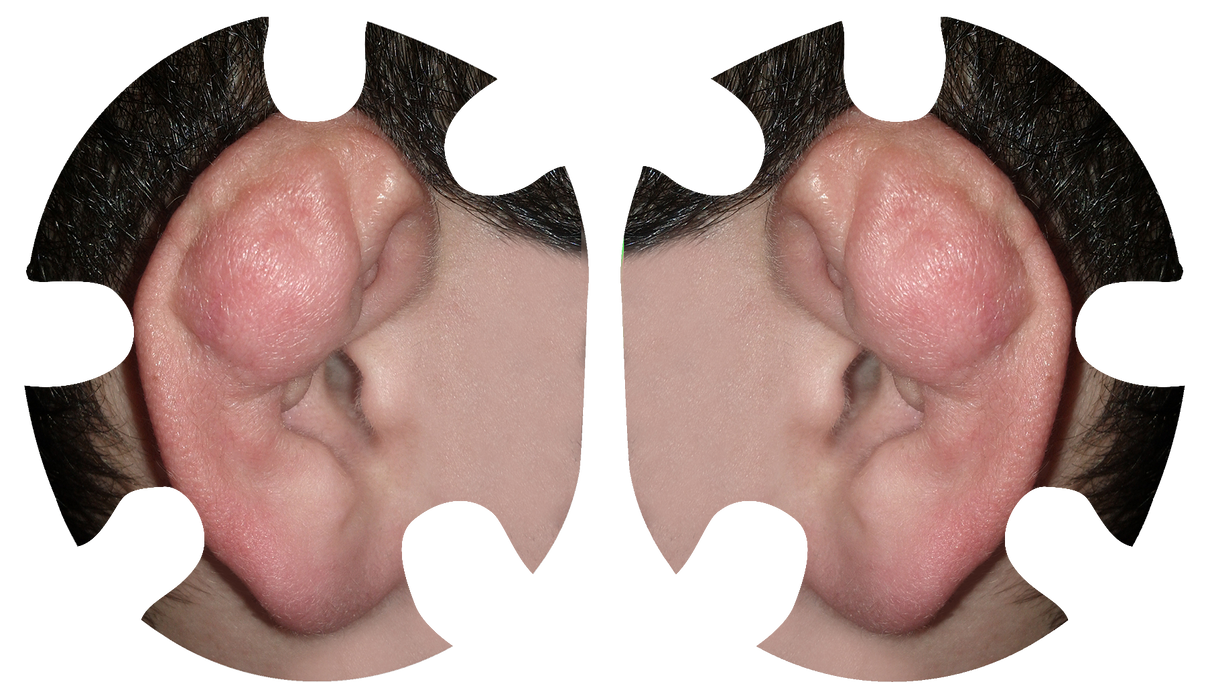 Cauliflower Ear Headgear Decal crossfaceGEAR